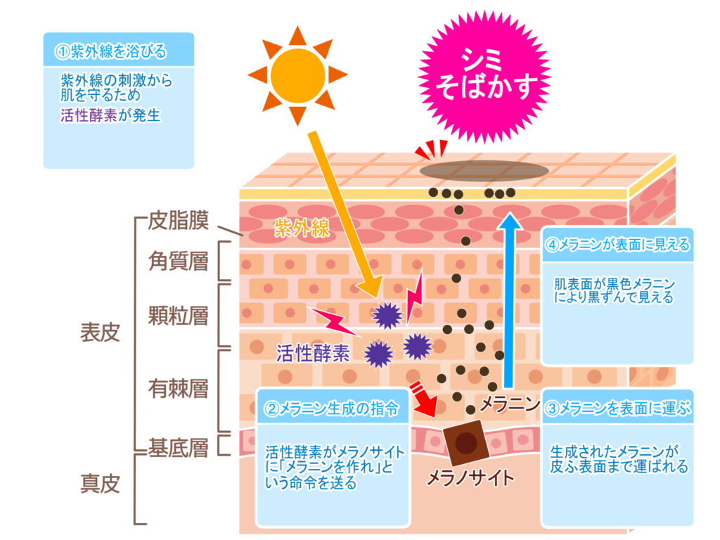 しみそばかすのメカニズム