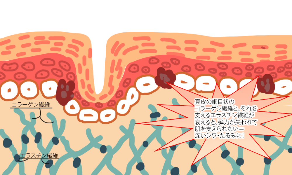 深いシワのメカニズム